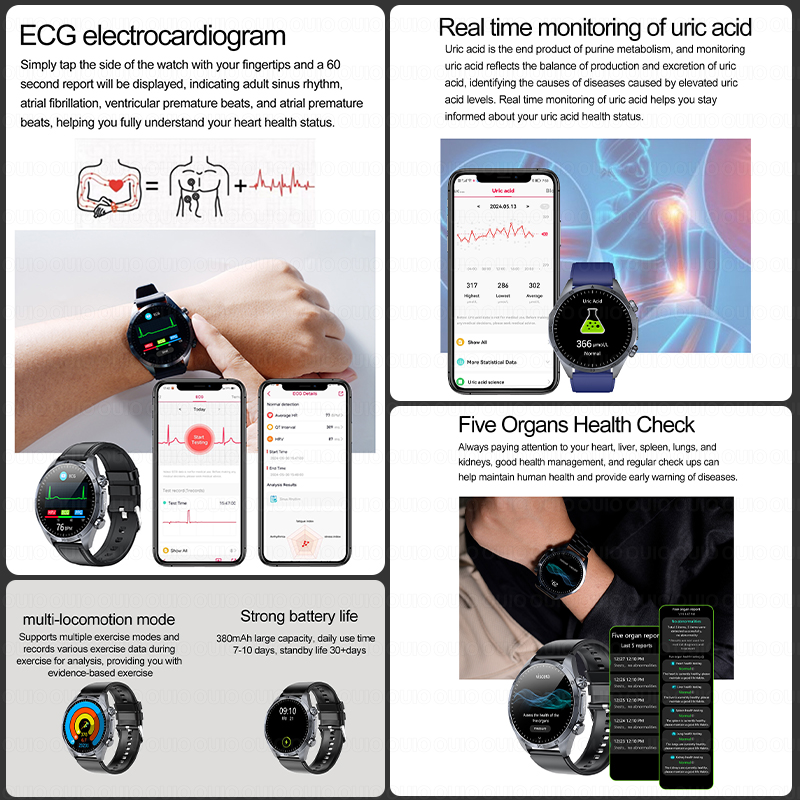 2026 Gloednieuwe Upgrade Gezon - Smartwatch Branded Watches For Women recensie en prijs